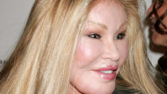 A murit Jocelyne Wildenstein, supranumită ''Catwoman''