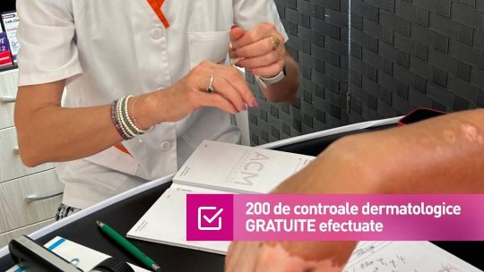 Controale dermatologice gratuite, pentru 200 de persoane din 4 județe